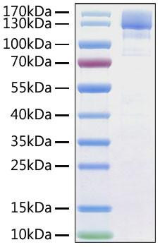 Recombinant SARS-CoV Spike S1 Protein (RPCB0868)