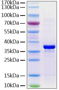 Recombinant Human Fibrinogen like 1/FGL1 Protein (RPCB0900)