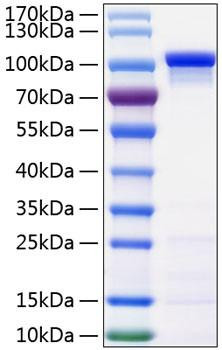 Recombinant Human Catenin beta-1/CTNNB1 Protein (RPCB0907)