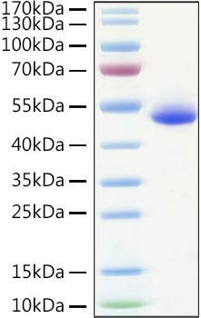 Recombinant Human TNFRSF10B/DR5/TRAIL-R2/CD262 Protein (RPCB0916)