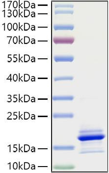 Recombinant Human CCL21 Protein (RPCB0921)