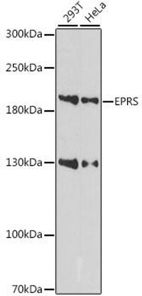 Anti-EPRS Antibody (CAB15245)