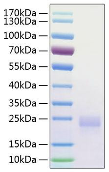 Recombinant Human CTLA-4/CD152 Protein (RPCB0939)