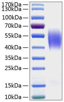 Recombinant Human CEACAM5/CEA/CD66e Protein (RPCB0940)