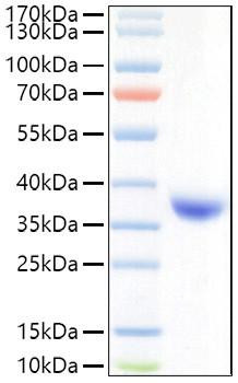 Recombinant SARS-COV-2 Spike RBD(Lambda/C.37)  Protein (RPCB0947)