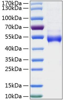 Recombinant Human Galectin-9/LGALS9 Protein (RPCB0957)