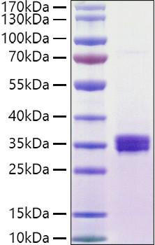 Recombinant Human NKG2D ligand 1/ULBP1 Protein (RPCB0958)