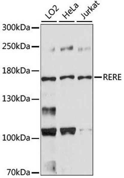 Anti-RERE Antibody (CAB15255)