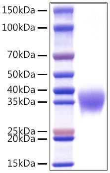 Recombinant Human Apolipoprotein H/ApoH Protein (RPCB0965)