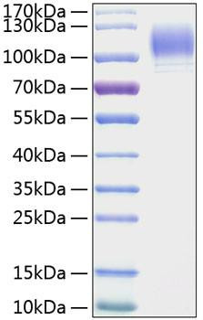 Recombinant Mouse P-Selectin/SELP/CD62P Protein (RPCB0967)