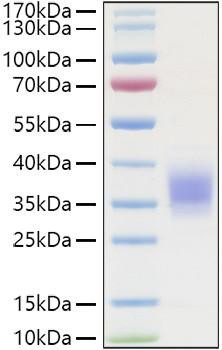 Recombinant Human TNFRSF1A/TNF-R1/CD120a Protein (RPCB0970)