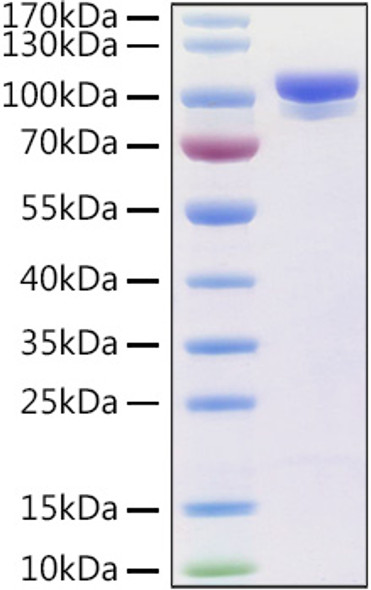 Recombinant Human Prolyl endopeptidase FAP Protein (RPCB0971)