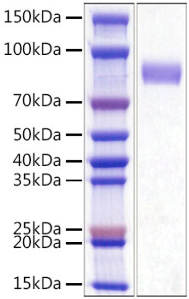 Recombinant Mouse Siglec-3/CD33 Protein (RPCB0973)