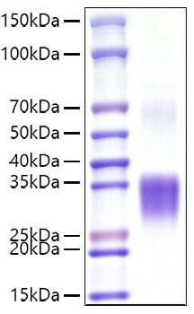 Recombinant Mouse CD8a Protein (RPCB0977)