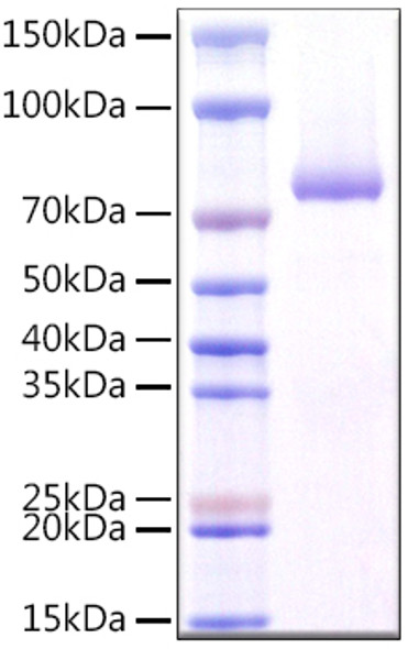 Recombinant Human CLEC7A/Dectin-1/CD369 Protein (RPCB0982)