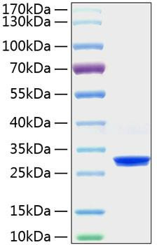 Recombinant Mouse C-Reactive Protein/CRP Protein (RPCB0987)