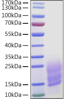 Recombinant Human Fibronectin/CIG/FN1 Protein (RPCB0990)