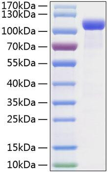 Recombinant Mouse EphB2 Protein (RPCB0999)