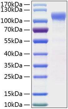 Recombinant Human LRRC4 Protein (RPCB1009)