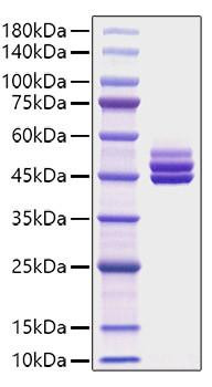 Recombinant Mouse IL-12B/IL-12 p40 Protein (RPCB1028)