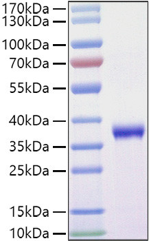 Recombinant SARS-COV-2 Spike RBD(L452R,T478K)  Protein (RPCB1038)