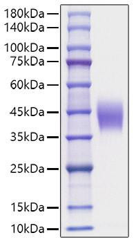 Recombinant Mouse IL-4R alpha/CD124 Protein (RPCB1044)
