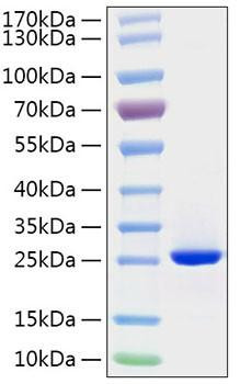 Recombinant Human FGF-19 Protein (RPCB1047)