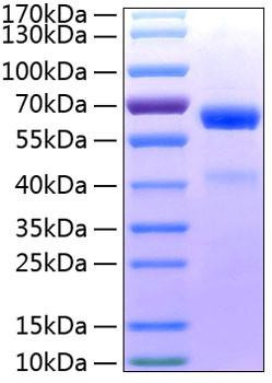Recombinant Human ADAM8/CD156a Protein (RPCB1053)