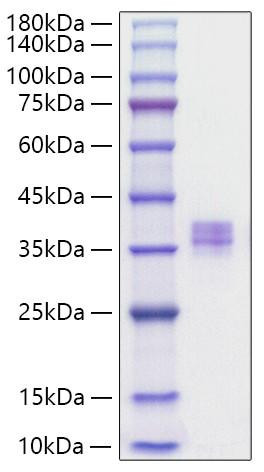 Recombinant Human MMP-7 Protein (RPCB1082)