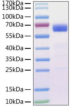 Recombinant MERS-CoV Spike RBD  Protein (RPCB1087)