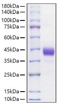 Recombinant Mouse CD52 Protein (RPCB1089)