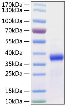 Recombinant Human Follistatin-like protein 3/FSTL3 Protein (RPCB1119)