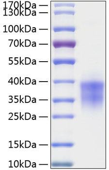 Recombinant Human TWSG1 Protein (RPCB1126)