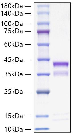 Recombinant Mouse Cathepsin S/CTSS Protein (RPCB1133)
