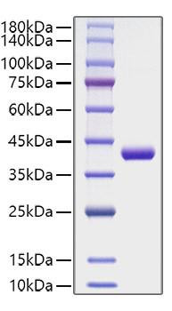 Recombinant Human CCL4/MIP-1Î² Protein (RPCB1199)
