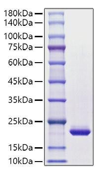 Recombinant Human CSF-3/G-CSF Protein (RPCB1230)
