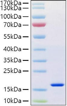 Recombinant Human REG-4 Protein (RPCB1238)