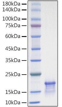 Recombinant Human CCL21/6Ckine Protein (RPCB1253)
