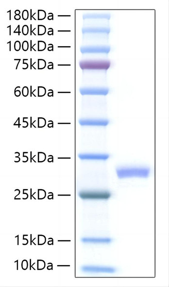 Recombinant Mouse IL-27A Protein (RPCB1257)