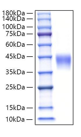 Recombinant Human Lutropin beta chain/LHB Protein (RPCB1269)