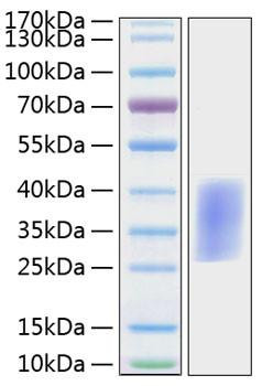 Recombinant Mouse PD-1/PDCD1/CD279 Protein (RPCB1296)