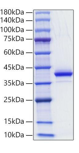 Recombinant Human CD81 Protein (RPCB1297)