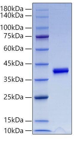 Recombinant Mouse IGF-I Protein (RPCB1305)