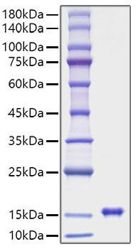 Recombinant Rat Leptin/LEP Protein (RPCB1313)
