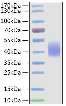 Recombinant Mouse B7-2/CD86 Protein (RPCB1319)
