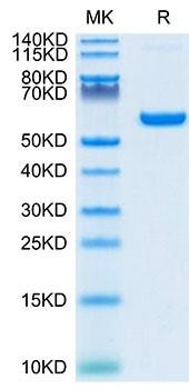 Recombinant SARS-COV-2 Spike RBD  Protein (RPCB1349)