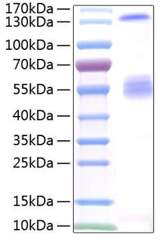 Recombinant Human IGF2BP2 Protein (RPCB1378)