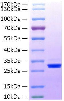 Recombinant Human BTN3A3 Protein (RPCB1390)