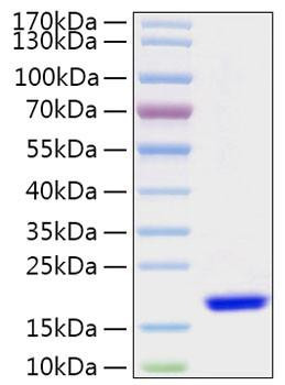 Recombinant Human FABP7/B-FABP/BLBP Protein (RPCB1401)