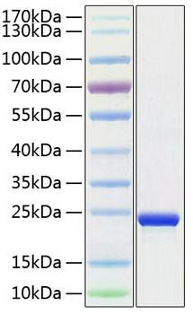 Recombinant Human TMPO Protein (RPCB1420)